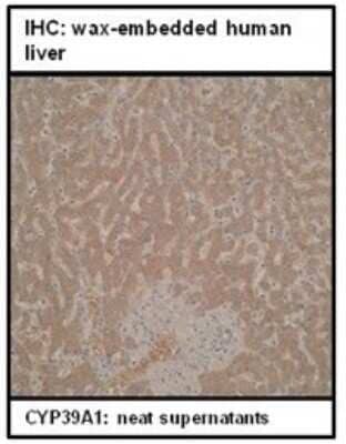 Immunohistochemistry CYP39A1 Antibody (M30P6D6) - BSA Free