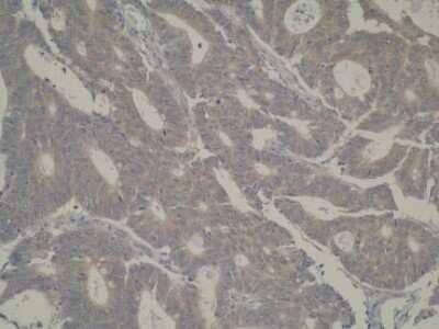 Immunohistochemistry CYP39A1 Antibody (M30P6D6) - BSA Free