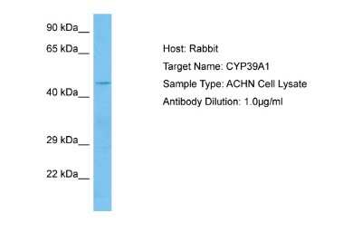 Western Blot: CYP39A1 Antibody [NBP2-83988] - Host: Rabbit. Target Name: CYP39A1. Sample Tissue: Human ACHN Whole Cell lysates. Antibody Dilution: 1ug/ml