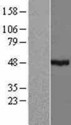 Western Blot: CYP39A1 Overexpression Lysate (Adult Normal) [NBP2-07001] Left-Empty vector transfected control cell lysate (HEK293 cell lysate); Right -Over-expression Lysate for CYP39A1.