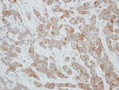 Immunohistochemistry-Paraffin CYP3A43 Antibody