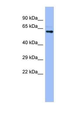 Western Blot: CYP4A22 Antibody [NBP1-80496] - Human Stomach, concentration 0.2-1 ug/ml.