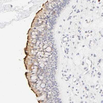 Immunohistochemistry-Paraffin CYP4B1 Antibody