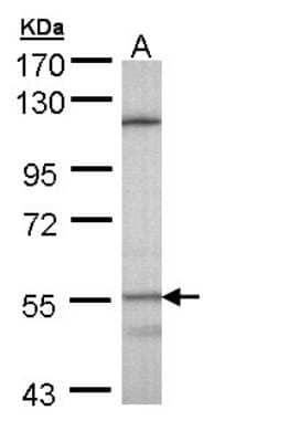Western Blot: CYP4B1 Antibody [NBP1-32691] - Sample (30 ug of whole cell lysate) A: Hela S37C 5% SDS PAGE, antibody diluted at 1:1000.