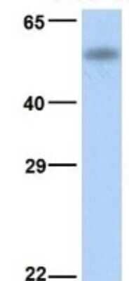 Western Blot CYP4B1 Antibody - BSA Free