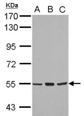 Western Blot: CYP4B1 Antibody [NBP2-16068] - Sample (30 ug of whole cell lysate) A: A549 B: H1299 C: MCF-7 7. 5% SDS PAGE gel, diluted at 1:5000.