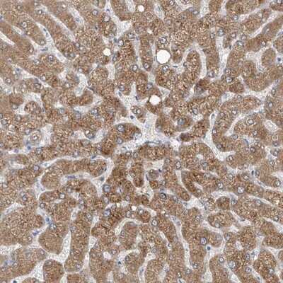 Immunohistochemistry-Paraffin: CYP4V2 Antibody [NBP1-85361] - Staining of human liver shows moderate cytoplasmic positivity in hepatocytes.