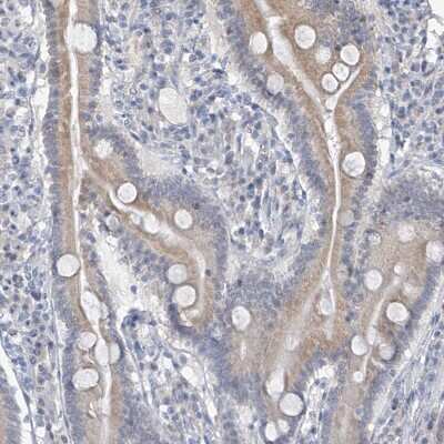 Immunohistochemistry-Paraffin: CYP4V2 Antibody [NBP1-85361] - Staining of human gastrointestinal shows moderate cytoplasmic positivity in glandular cells.