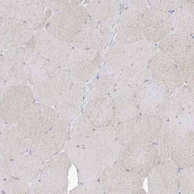 Immunohistochemistry-Paraffin: CYP4V2 Antibody [NBP1-85361] - Staining of human skeletal muscle shows very weak positivity in myocytes.