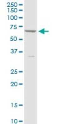 Western Blot: CYP4V2 Antibody [H00285440-B01P] - Analysis of CYP4V2 expression in HeLa.