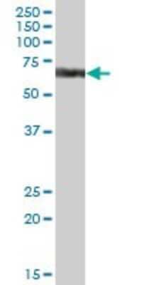 Western Blot: CYP4V2 Antibody [H00285440-B01P] - Analysis of CYP4V2 expression in human liver.