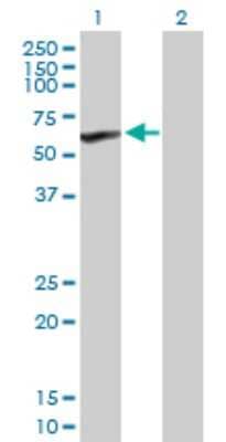 Western Blot: CYP4V2 Antibody [H00285440-B01P] - Analysis of CYP4V2 expression in transfected 293T cell line by CYP4V2 polyclonal antibody.  Lane1:CYP4V2 transfected lysate(57.75 KDa). Lane2:Non-transfected lysate.