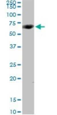 Western Blot: CYP4V2 Antibody [H00285440-D01P] - Analysis of CYP4V2 expression in human kidney.