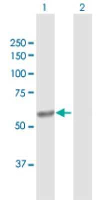 Western Blot: CYP4V2 Antibody [H00285440-D01P] - Analysis of CYP4V2 expression in transfected 293T cell line by CYP4V2 polyclonal antibody.Lane 1: CYP4V2 transfected lysate(60.70 KDa).Lane 2: Non-transfected lysate.