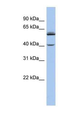 Western Blot: CYP4V2 Antibody [NBP1-60084] - Jurkat cell lysate, concentration 0.2-1 ug/ml.