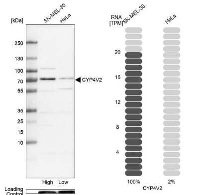 Western Blot: CYP4V2 Antibody [NBP1-85361] - Analysis in human cell line SK-MEL-30 and human cell line HeLa.