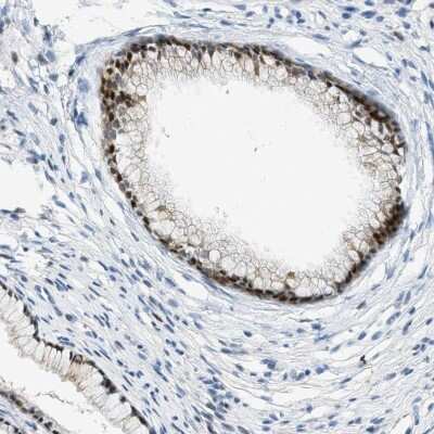 Immunohistochemistry-Paraffin CYP4X1 Antibody