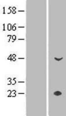 Western Blot: CYP4Z1 Overexpression Lysate (Adult Normal) [NBP2-04968] Left-Empty vector transfected control cell lysate (HEK293 cell lysate); Right -Over-expression Lysate for CYP4Z1.