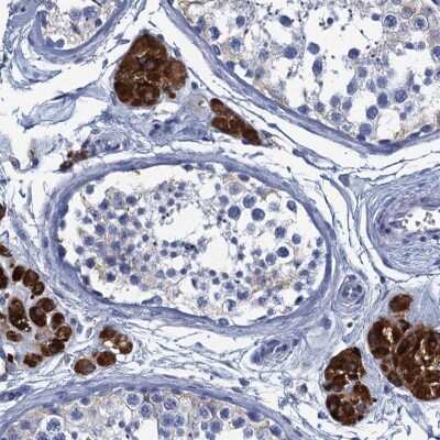 Immunohistochemistry-Paraffin: CYP51A1 Antibody [NBP2-48733] - Staining of human testis shows strong cytoplasmic positivity in Leydig cells.
