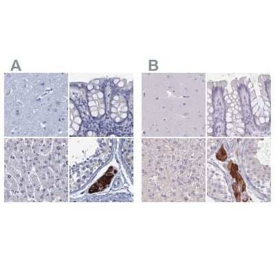 Immunohistochemistry-Paraffin: CYP51A1 Antibody [NBP2-48733] - Staining of human cerebral cortex, colon, liver and testis using Anti-CYP51A1 antibody NBP2-48733 (A) shows similar protein distribution across tissues to independent antibody NBP2-48793 (B).
