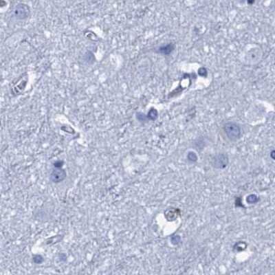 Immunohistochemistry-Paraffin: CYP51A1 Antibody [NBP2-48733] - Staining of human cerebral cortex.