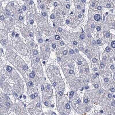 Immunohistochemistry-Paraffin: CYP51A1 Antibody [NBP2-48733] - Staining of human liver.