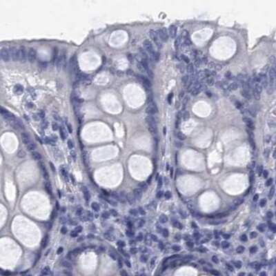 Immunohistochemistry-Paraffin: CYP51A1 Antibody [NBP2-48733] - Staining of human colon.