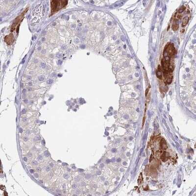 Immunohistochemistry-Paraffin: CYP51A1 Antibody [NBP2-48793] - Staining of human testis shows strong cytoplasmic positivity in Leydig cells.
