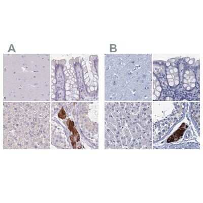 <b>Independent Antibodies Validation. </b>Immunohistochemistry-Paraffin: CYP51A1 Antibody [NBP2-48793] - Staining of human cerebral cortex, colon, liver and testis using Anti-CYP51A1 antibody NBP2-48793 (A) shows similar protein distribution across tissues to independent antibody NBP2-48733 (B).