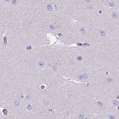 Immunohistochemistry-Paraffin: CYP51A1 Antibody [NBP2-48793] - Staining of human cerebral cortex.