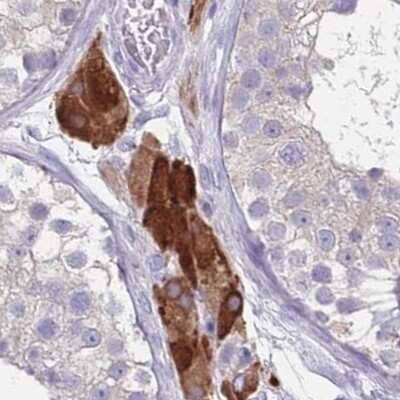 Immunohistochemistry-Paraffin: CYP51A1 Antibody [NBP2-48793] - Staining of human testis.