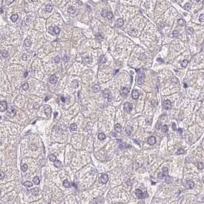 Immunohistochemistry-Paraffin: CYP51A1 Antibody [NBP2-48793] - Staining of human liver.