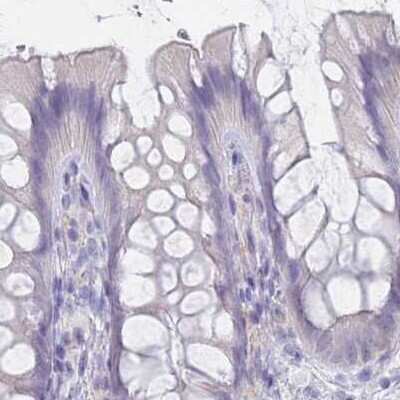 Immunohistochemistry-Paraffin: CYP51A1 Antibody [NBP2-48793] - Staining of human colon.