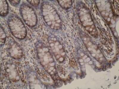 Immunohistochemistry: CYP51A1 Antibody (N6-P2H5-G8) [NBP2-50216] - Photomicrograph of normal tissue.