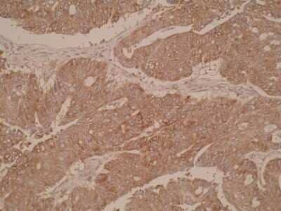 Immunohistochemistry: CYP51A1 Antibody (N6-P2H5-G8) [NBP2-50216] - Staining of colon tissue.