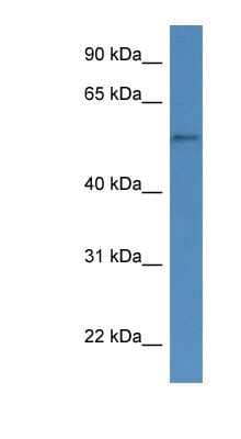 Western Blot: CYP51A1 Antibody [NBP1-79790] - Hela cell lysate, concentration 0.2-1 ug/ml.