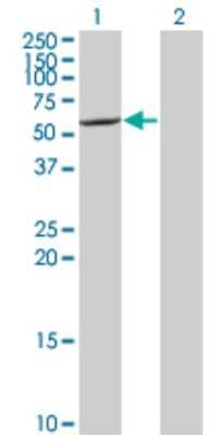 Western Blot: CYP7B1 Antibody (2B11) [H00009420-M06] - Analysis of CYP7B1 expression in transfected 293T cell line by CYP7B1 monoclonal antibody (M06), clone 2B11. Lane 1: CYP7B1 transfected lysatE (58.256 KDa). Lane 2: Non-transfected lysate.