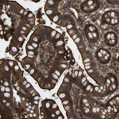 Immunohistochemistry: CYP7B1 Antibody [NBP1-87013] - Staining of human small intestine shows strong membranous, and cytoplasmic positivity in glandular cells.