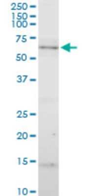 Western Blot: CYP7B1 Antibody [H00009420-A01] - Analysis of CYP7B1 expression in PC-12.