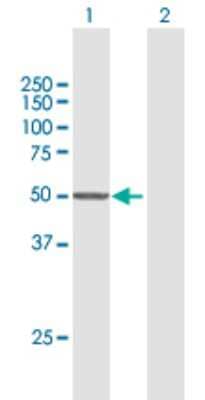 Western Blot: CYP7B1 Antibody [H00009420-B01P] - Analysis of CYP7B1 expression in transfected 293T cell line by CYP7B1 polyclonal antibody.  Lane 1: CYP7B1 transfected lysate(58.30 KDa). Lane 2: Non-transfected lysate.