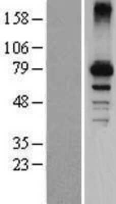 Western Blot CYP7B1 Overexpression Lysate