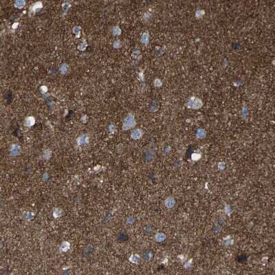 Immunohistochemistry-Paraffin: CYREN Antibody [NBP1-82120] - Staining of human cerebral cortex shows strong positivity in neuropil.