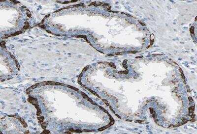 Immunohistochemistry-Paraffin: CYREN Antibody [NBP1-82120] - Staining of human prostate shows moderate to strong cytoplasmic postivity in glandualr cells.