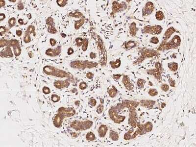 Immunohistochemistry-Paraffin: CYREN Antibody [NBP2-98664] - Immunochemical staining of human CYREN in human esophagus with rabbit polyclonal antibody at 1:100 dilution, formalin-fixed paraffin embedded sections.