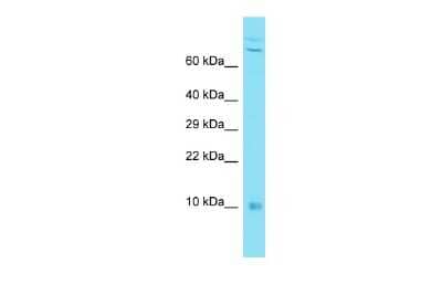 Western Blot: CYREN Antibody [NBP2-82942] - Host: Rabbit. Target Name: C7orf49. Sample Type: MDA-MB-435S Whole Cell lysates. Antibody Dilution: 1.0ug/mlC7orf49 is supported by BioGPS gene expression data to be expressed in MDA-MB435