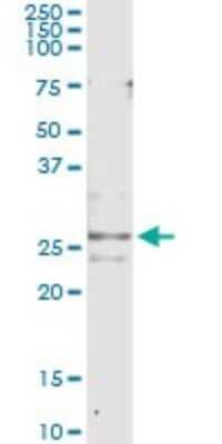 Immunoprecipitation: CYRPTIC/CFC1 Antibody (2G4) [H00055997-M09] - Analysis of CFC1 transfected lysate using anti-CFC1 monoclonal antibody and Protein A Magnetic Bead, and immunoblotted with CFC1 rabbit polyclonal antibody.