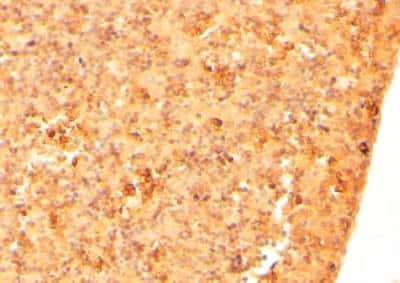 Immunohistochemistry-Paraffin: CYRPTIC/CFC1 Antibody [NB600-805] - Staining of Mouse Embryo Liver. Steamed antigen retrieval with citrate buffer pH 6, HRP-staining.  