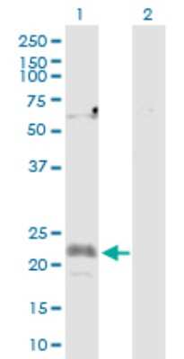 Western Blot: CYRPTIC/CFC1 Antibody [H00055997-D01P] - Analysis of CFC1 expression in transfected 293T cell line by CFC1 polyclonal antibody.Lane 1: CFC1 transfected lysate(24.60 KDa).Lane 2: Non-transfected lysate.