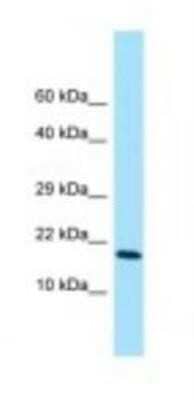 Western Blot: CYRPTIC/CFC1 Antibody [NBP1-98527] - Hela Cell Lysate 1.0ug/ml, Gel Concentration: 10-20%