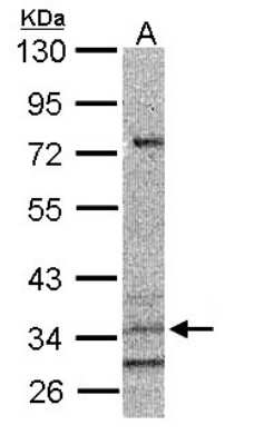 Western Blot: CYSLTR1 Antibody [NBP2-16072] - Sample (30 ug of whole cell lysate) A: A431 10% SDS PAGE gel, diluted at 1:1000.